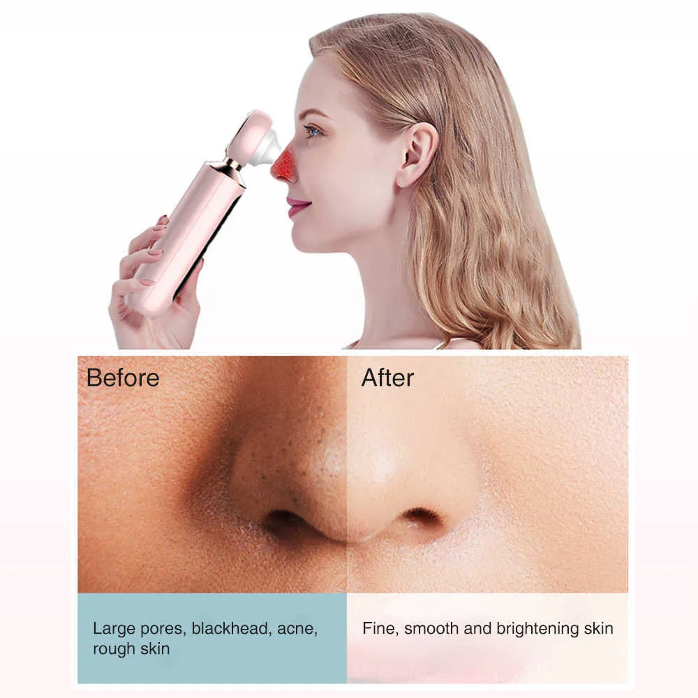 𝙉𝙤𝙤𝙧é 𝙂𝙡𝙤𝙬™ Blackhead Suction Machine