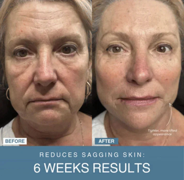 𝙉𝙤𝙤𝙧é 𝙂𝙡𝙤𝙬™ 7-in-1 LED Anti-Aging/Wrinkle Apparatus